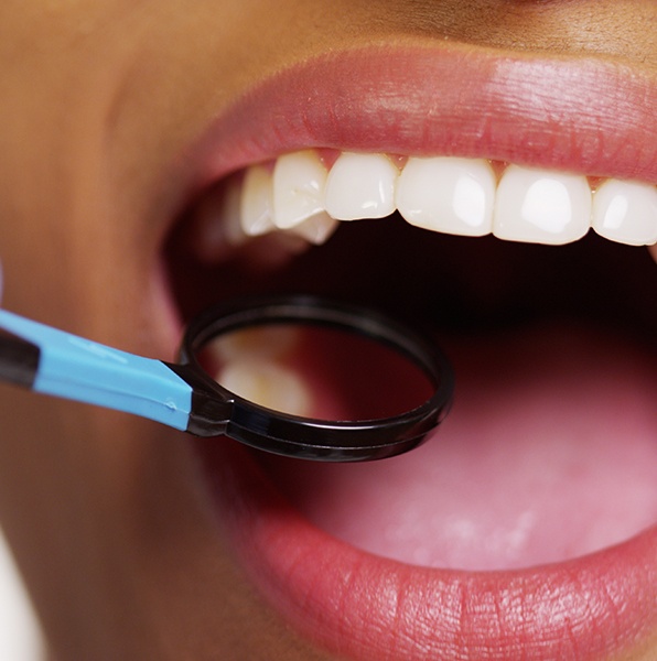Dentist examining patient's smile after tooth-colored filling restorative dentistry
