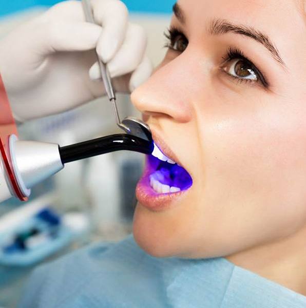 A dentist performing dental filling treatment on a woman