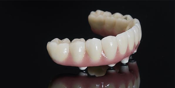 Dental implant supported denture prior to placement