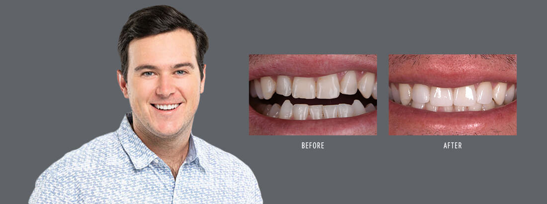 Jacksonville dental patient Roger with before and after images of his smile
