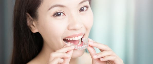 Woman placing an Invisalign clear braces tray