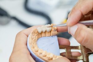 Dentist holds an impression while fitting crowns over the teeth.
